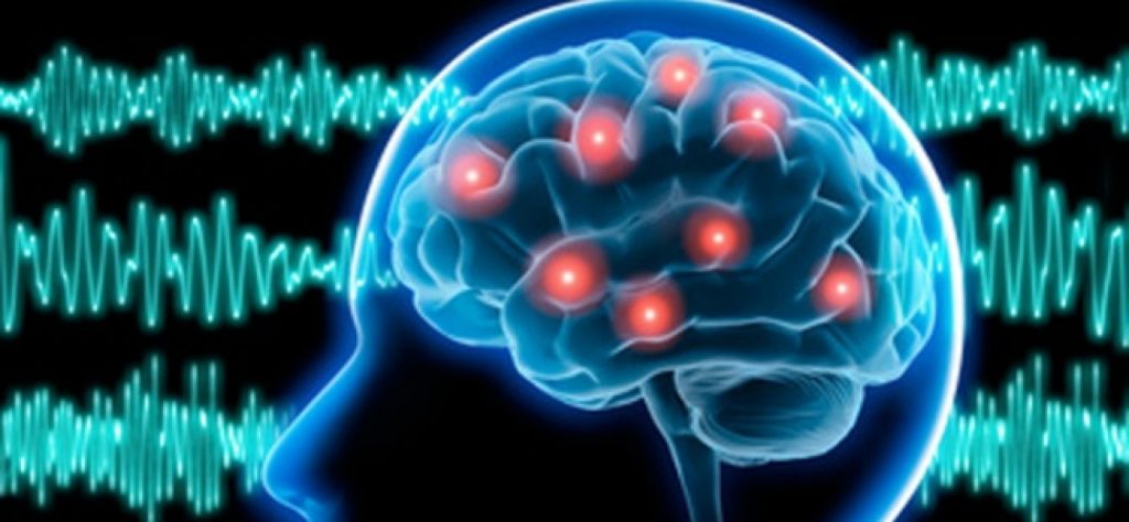 Día internacional de la Epilepsia: lo que hay que saber