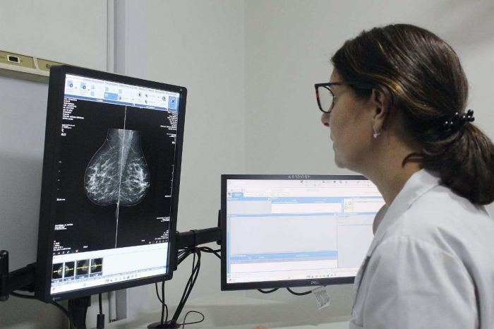 LA PBA COMENZARÁ A INDICAR LA MAMOGRAFÍA A LOS 40 AÑOS